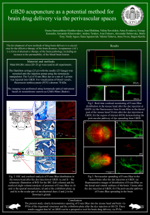 GB20 acupuncture as a potential method for brain drug delivery via the perivascular spaces